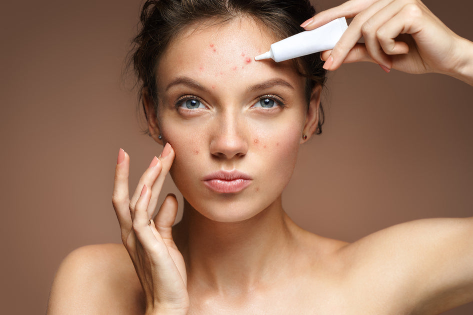 Does Makeup Cause Acne? Charette Cosmetics